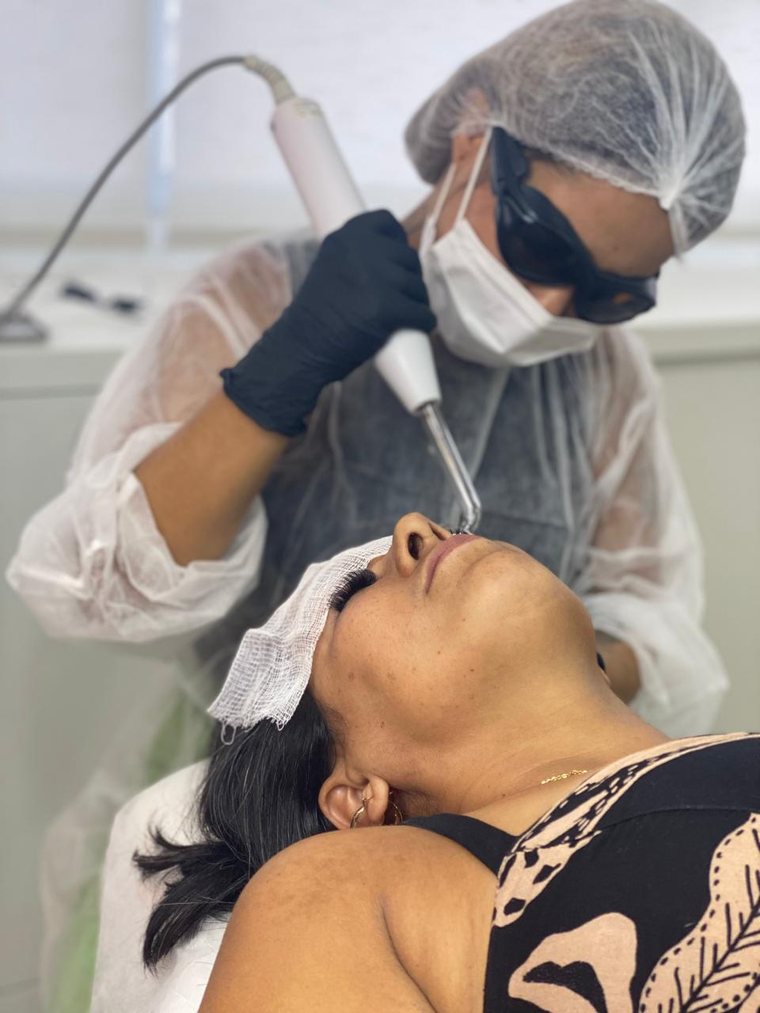Sessão de remoção a laser no Studio Karol Mendes