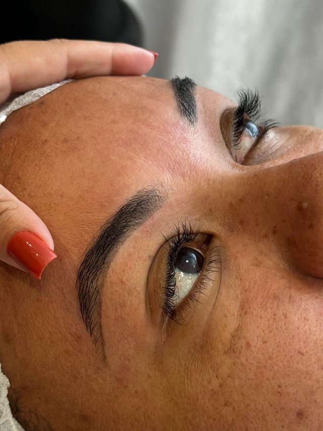 Sobrancelha depois do procedimento
